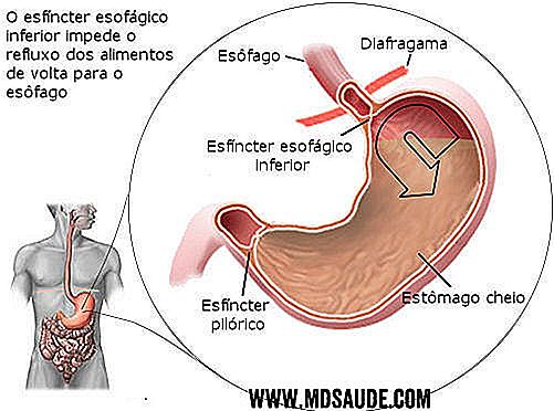 Cetosis ruidos estomago