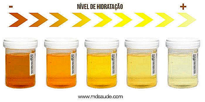 Tiras orina cetosis cuando tomarlas Tiras orina cetosis cuando tomarlas