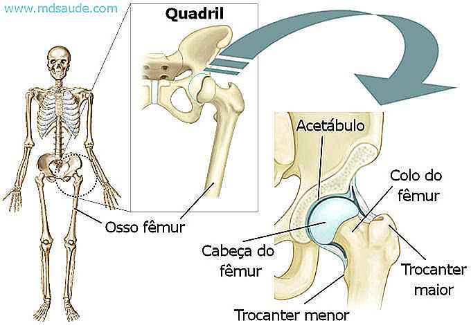 El cáncer de huesos duele